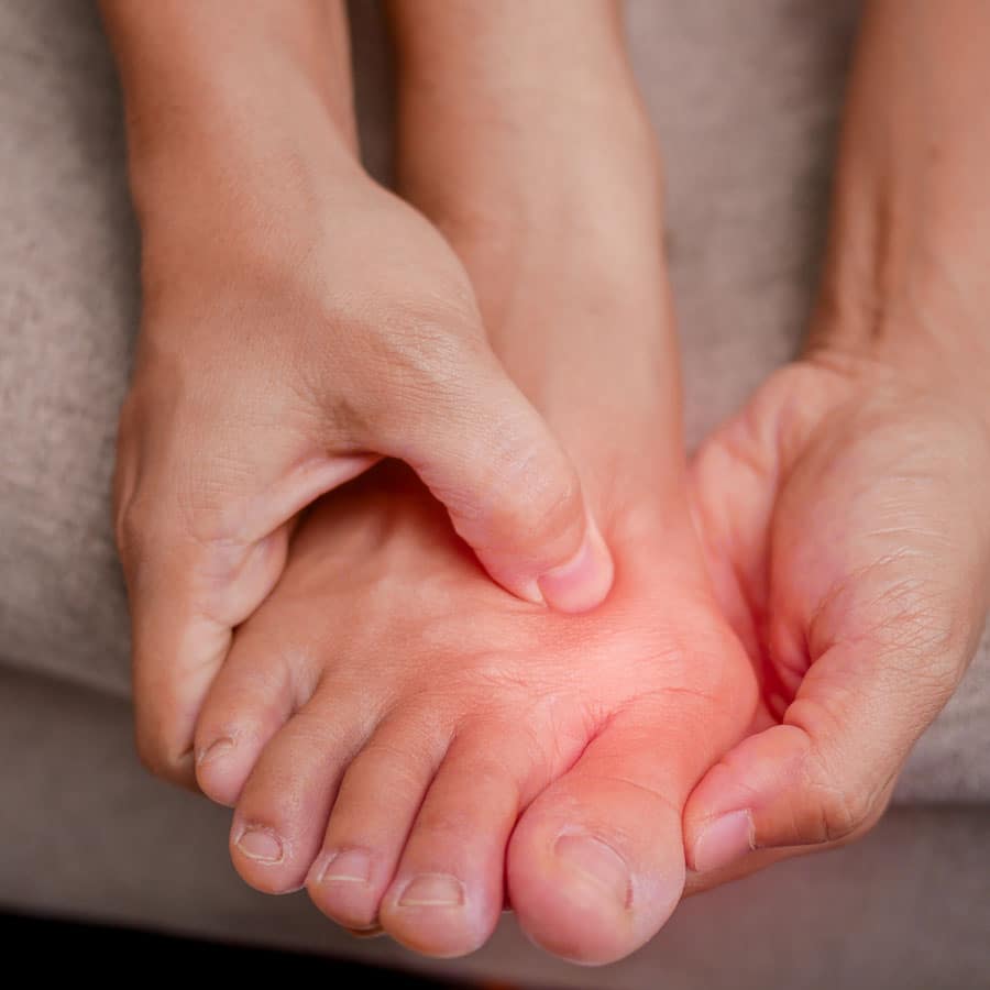 How Custom Insoles Can Help Bunions & Hammertoes