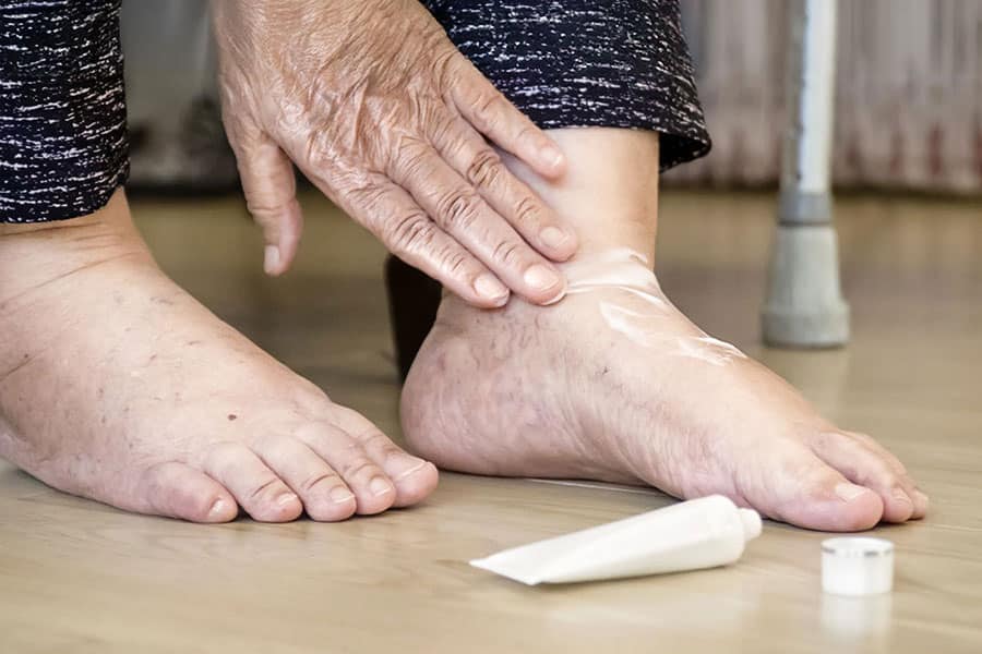 Why your feet need extra care