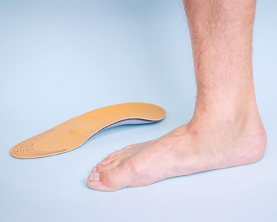 Understanding Fallen Arches (Pes Planus)